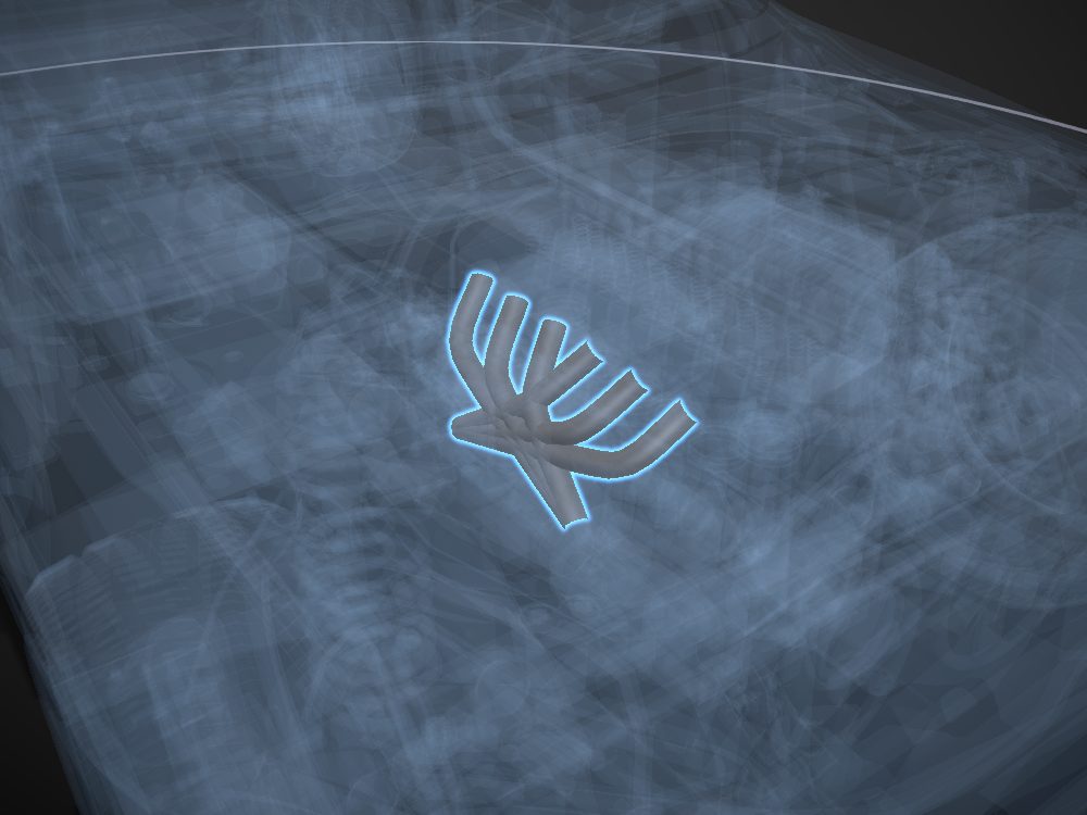 Exhaust manifold highlighted on the car