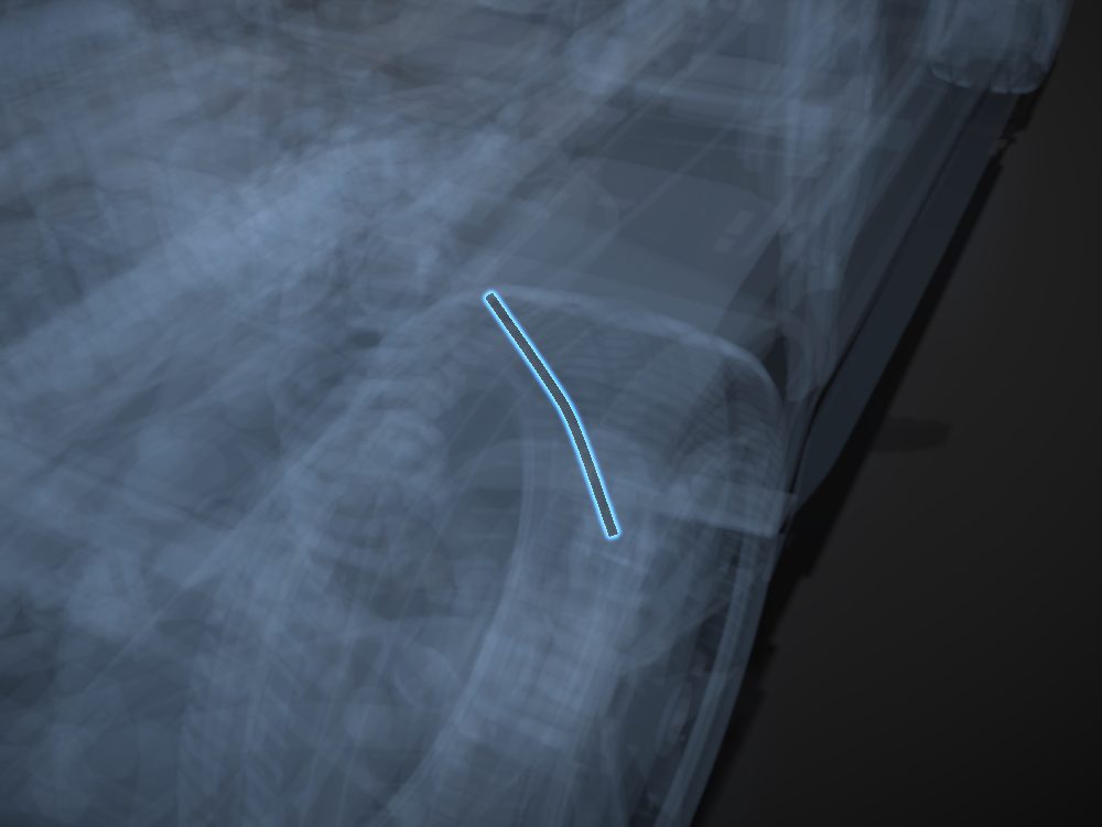 Brake line highlighted on the car